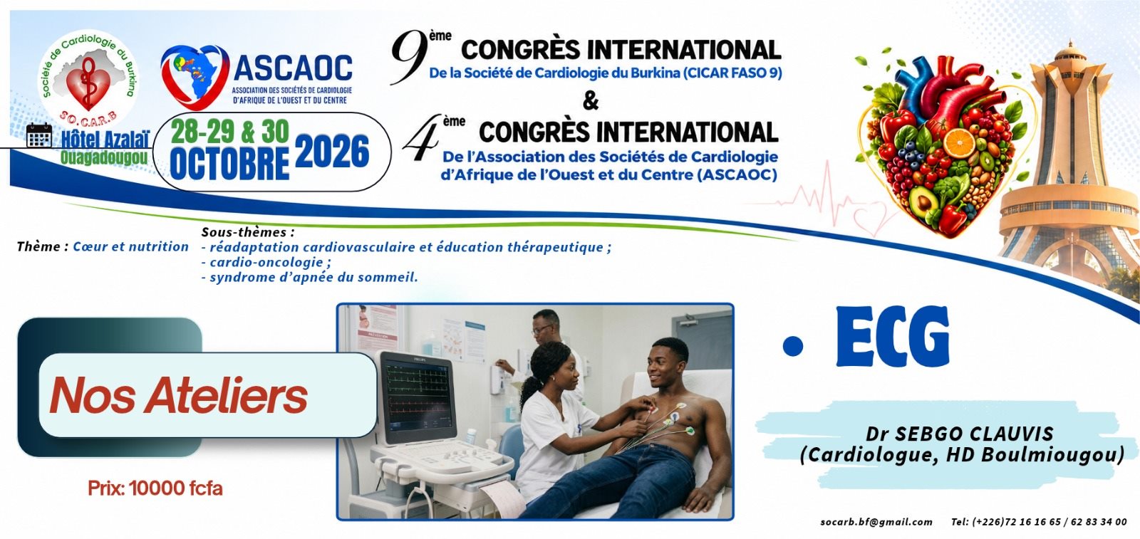ECG